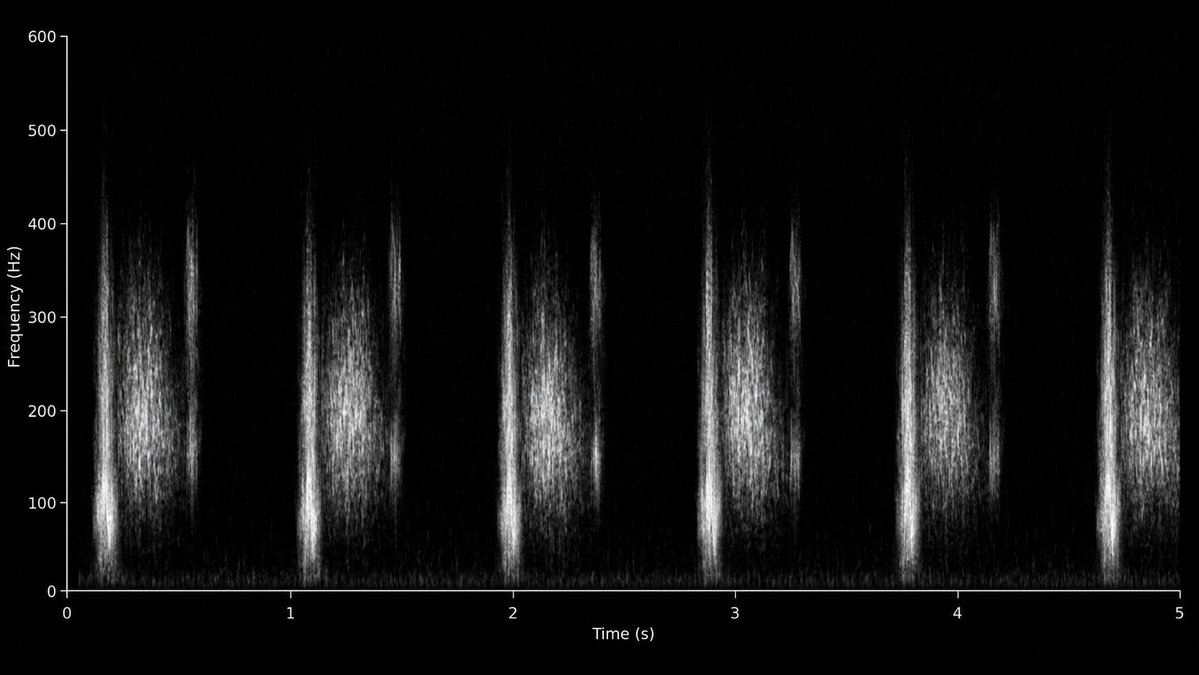 Erzeugung eines Aortenstenose-Spektrogramms